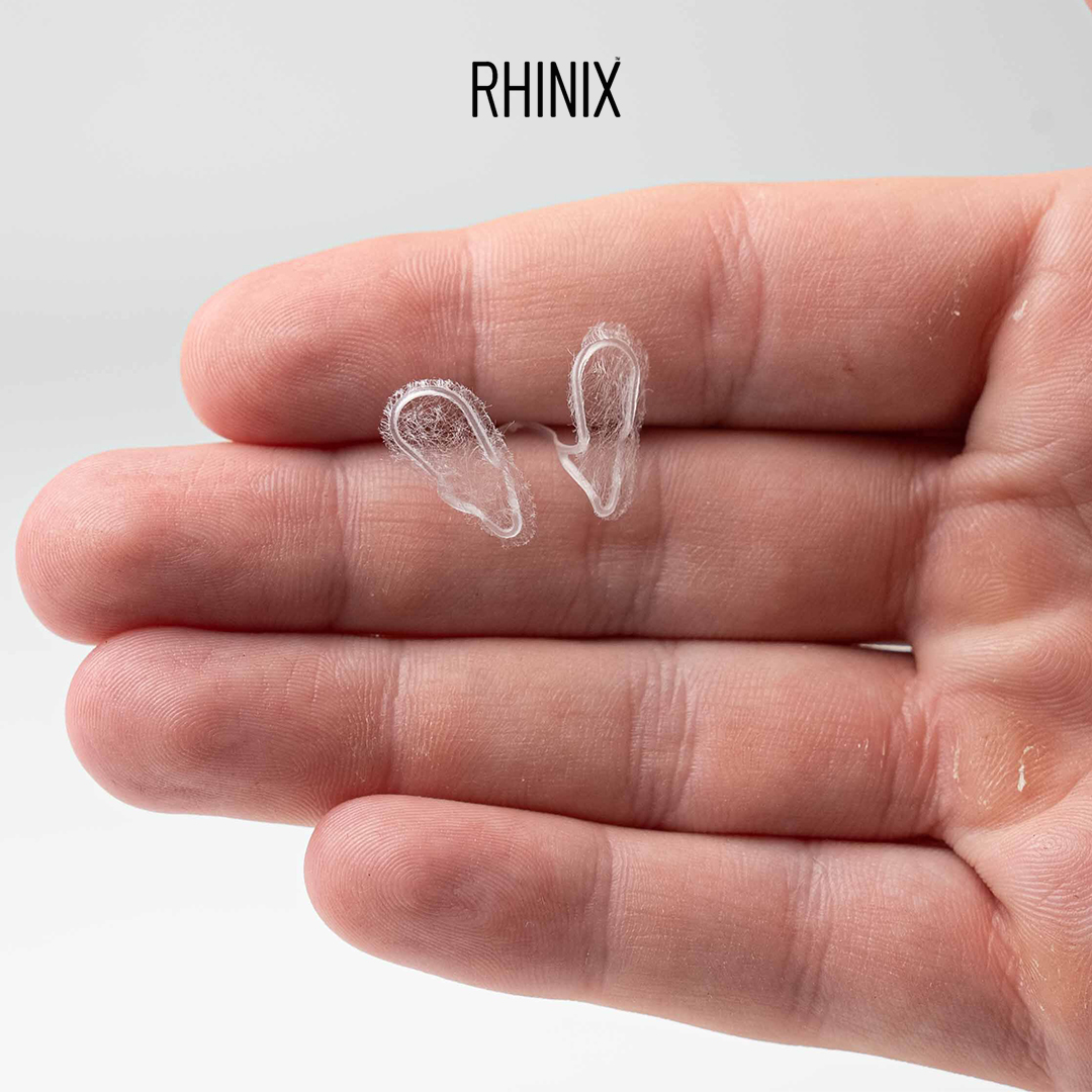 Rhinix MPA 2